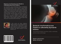 Produktbild: Badanie morfometryczne Patelli w ca&iquest;kowitej wymianie kolana