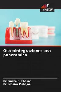 Produktbild: Osteointegrazione: una panoramica