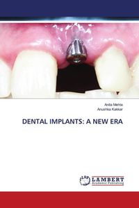 Produktbild: Dental Implants: a New Era