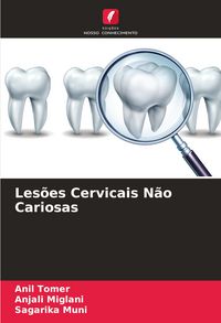 Produktbild: Les&otilde;es Cervicais N&atilde;o Cariosas