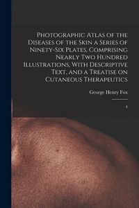 Produktbild: Photographic Atlas of the Diseases of the Skin a Series of Ninety-six Plates, Comprising Nearly two Hundred Illustrations, With Descriptive Text, and