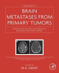 Produktbild: Brain Metastases from Primary Tumors, Volume 3