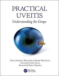 Produktbild: Williams, G: Practical Uveitis