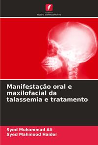 Produktbild: Manifesta&ccedil;&atilde;o oral e maxilofacial da talassemia e tratamento