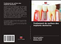 Produktbild: Traitement de surface des implants dentaires