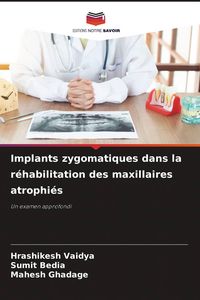 Produktbild: Implants zygomatiques dans la r&eacute;habilitation des maxillaires atrophi&eacute;s