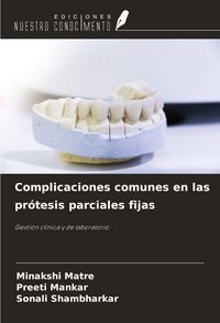 Produktbild: Complicaciones comunes en las pr&oacute;tesis parciales fijas