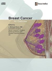 Produktbild: Breast Cancer
