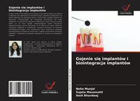 Produktbild: Gojenie si&iquest; implant&oacute;w i biointegracja implant&oacute;w