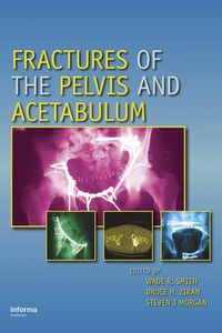 Produktbild: Fractures of the Pelvis and Acetabulum