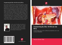 Produktbild: Implanta&ccedil;&atilde;o Bio-Artificial de Rins