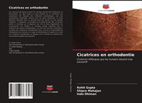 Produktbild: Cicatrices en orthodontie