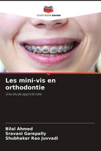 Produktbild: Les mini-vis en orthodontie