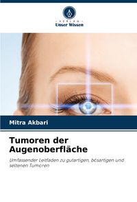 Produktbild: Tumoren der Augenoberfl&auml;che
