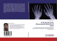 Produktbild: A Study On Early Rheumatoid Arthritis In India