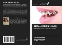 Produktbild: Distalizaci&oacute;n Molar