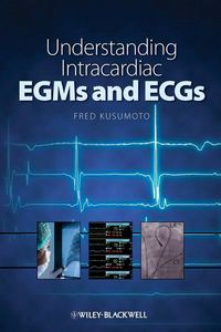 Produktbild: Understanding Intracardiac EGMs and ECGs