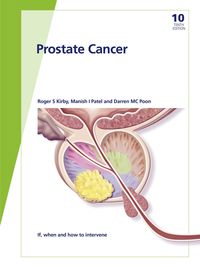 Produktbild: Fast Facts: Prostate Cancer