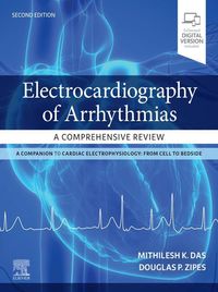 Produktbild: Electrocardiography of Arrhythmias: A Comprehensive Review E-Book