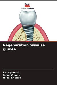 Produktbild: R&eacute;g&eacute;n&eacute;ration osseuse guid&eacute;e