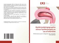 Produktbild: Hyst&eacute;rosalpingographie versus hyst&eacute;roscopie en cas d'infertilit&eacute;