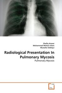 Produktbild: Anwar, S: Radiological Presentation In Pulmonary Mycosis