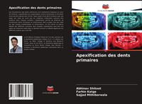 Produktbild: Apexification des dents primaires