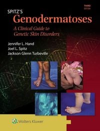 Produktbild: Spitz's Genodermatoses