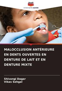 Produktbild: Malocclusion Ant&eacute;rieure En Dents Ouvertes En Denture De Lait Et En Denture Mixte