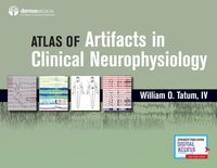 Produktbild: Atlas of Artifacts in Clinical Neurophysiology
