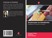 Produktbild: Acelera&ccedil;&atilde;o na Ortodontia