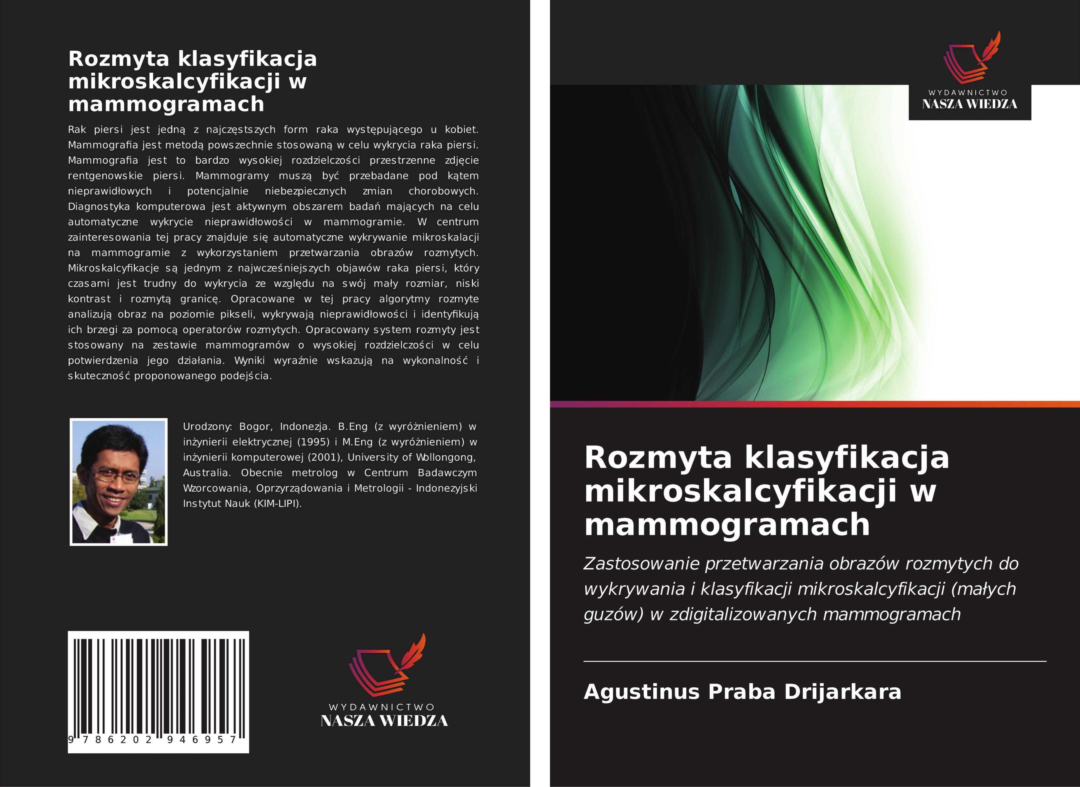 Produktbild: Rozmyta klasyfikacja mikroskalcyfikacji w mammogramach
