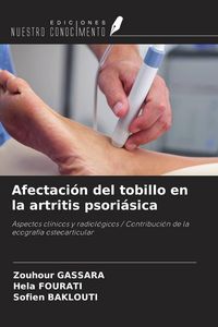 Produktbild: Afectaci&oacute;n del tobillo en la artritis psori&aacute;sica