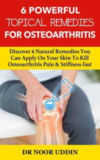Produktbild: 6 Powerful Topical Remedies For Osteoarthritis