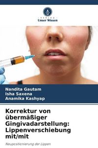 Produktbild: Korrektur von &uuml;berm&auml;&szlig;iger Gingivadarstellung: Lippenverschiebung mit/mit