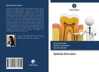 Produktbild: Apikale Extrusion