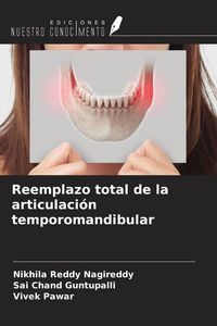 Produktbild: Reemplazo total de la articulaci&oacute;n temporomandibular