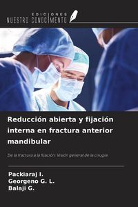Produktbild: Reducci&oacute;n abierta y fijaci&oacute;n interna en fractura anterior mandibular