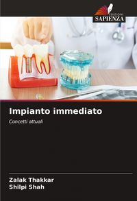 Produktbild: Impianto immediato