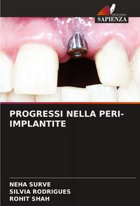 Produktbild: PROGRESSI NELLA PERI-IMPLANTITE