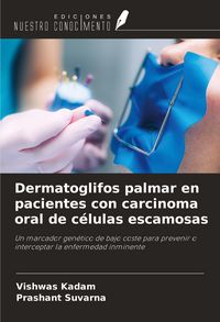 Produktbild: Dermatoglifos palmar en pacientes con carcinoma oral de c&eacute;lulas escamosas