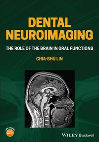 Produktbild: Dental Neuroimaging