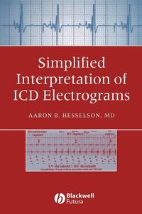 Produktbild: Simplified Interpretation of ICD Electrograms