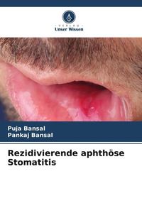 Produktbild: Rezidivierende aphth&ouml;se Stomatitis
