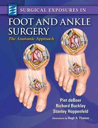 Produktbild: Deboer, P: Surgical Exposures in Foot & Ankle Surgery