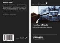 Produktbild: Mordida abierta