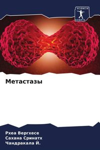 Produktbild: Metastazy