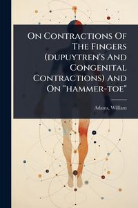 Produktbild: On Contractions Of The Fingers (dupuytren's And Congenital Contractions) And On "hammer-toe"