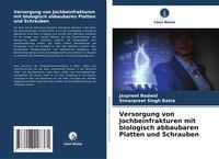 Produktbild: Versorgung von Jochbeinfrakturen mit biologisch abbaubaren Platten und Schrauben