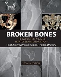 Produktbild: Broken Bones
